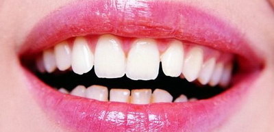做牙齿矫正要多长时间呀？