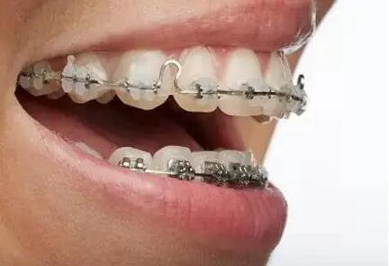 牙疼牙齿松动是什么原因