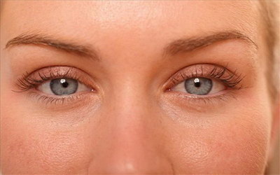 防止双眼皮增生的方法