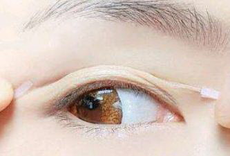 眼睛干涩视物模糊是什么原因引起的(眼睛干涩视物模糊该怎么办)