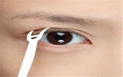 30岁能做双眼皮手术吗?