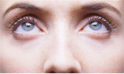 双眼皮手术一般多久可以消肿_做完双眼皮眼睛手术要多久才能完全恢复