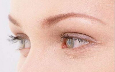 双眼皮手术后疤痕能不能恢复_双眼皮手术后疤痕怎么去除