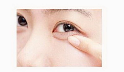 长时间贴双眼皮贴会成双眼皮吗(如何让双眼皮更持久？)