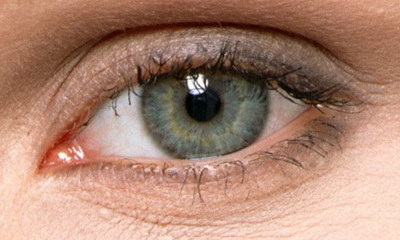 埋线双眼皮修复有几种方法