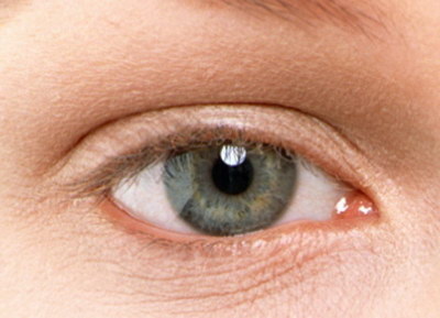 怎么判断双眼皮脂肪去多了_欧式双眼皮恢复过程