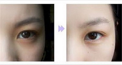 扩大眼睛的眼妆_有什么方法可以变大眼睛