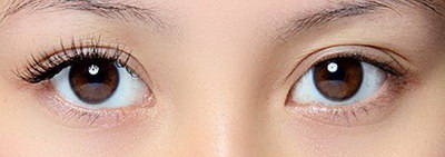 长期的黑眼圈怎么去除小妙招_黑眼圈和眼袋的区别