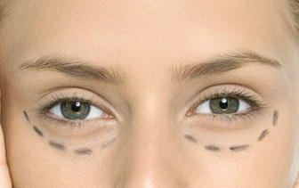 双眼皮手术方式和年龄(双眼皮手术—探讨当前的手术方式)