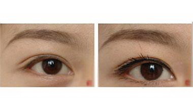双眼皮手术:一种增添魅力的外科技术_双眼皮的美:信阳最好的双眼皮医院