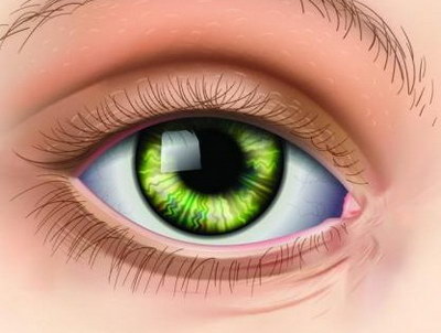 眼睛外眼角有一层肉「眼睛外眼角有一层膜」