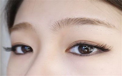 双眼皮术后眼角增生的治疗方法(双眼皮手术后眼角增生特别明显)