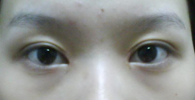 眼睛下长斑和哪个部位有关(眼睛下长斑的原因)