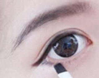 眼睛玻璃体出血最佳治疗方法(眼睛玻璃体出血是怎么回事)