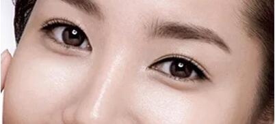 韩式双眼皮手术会是一个怎样的效果呢？