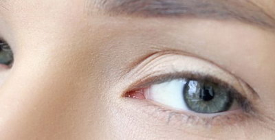 眼角提升手术过程3d(外眼角提升手术过程)