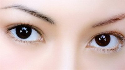 韩式三点双眼皮手术后恢复期多久