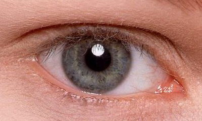 埋线双眼皮术前需要注意些什么呢？