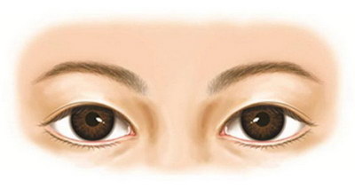 如何减轻黑眼圈和眼袋