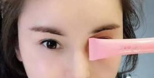 割双眼皮后抗疤痕药抹多少_割双眼皮的疤痕可以去掉吗