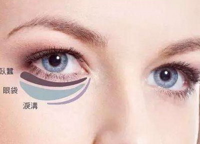 如何去除黑眼圈眼袋眼下面的细纹(什么是黑眼圈、眼袋和眼下细纹？)