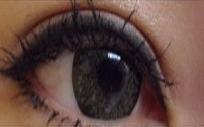 眼睛皮肿疼是什么病症