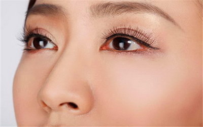 "水泡眼"可以用上眼睑抽脂术来治好吗？