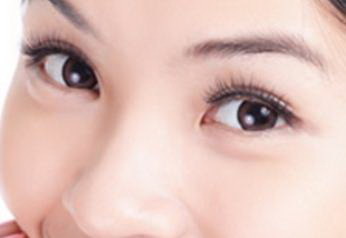 全切双眼皮能维持几年?