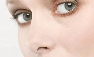 眼睛下面凹陷怎么回事_眼睛近视做双眼皮有影响吗