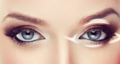 做了双眼皮手术会影响视力吗_双眼皮手术恢复一个月的效果