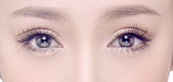 双眼皮手术的最佳年龄:分析重要因素_双眼皮手术:做出完美眼睛的方法