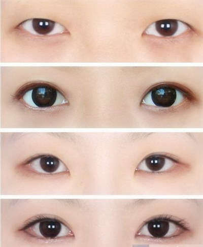 韩式双眼皮和欧式双眼皮哪个好看[欧式双眼皮和韩式双眼皮哪个好看]