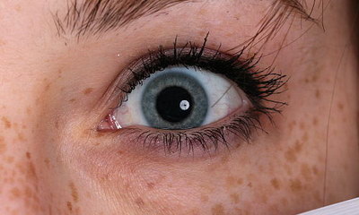 眼皮眼袋红肿过敏可以用红霉素眼膏吗