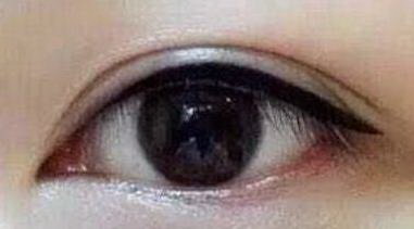 韩式双眼皮什么意思_韩式双眼皮需要学多少天