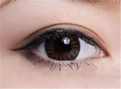 双眼皮手术术后有哪些注意事项？
