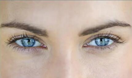 眼袋黑眼圈的形成原因_眼袋,黑眼圈,眼部皱纹形成的原因
