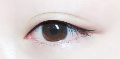 韩式双眼皮的适应人群以及独特的优势