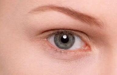 双眼皮一般需要多久恢复到自然_做完双眼皮要多久才能完全消肿