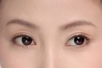 两个眼睛眼皮不一样的女生性格(两个眼睛眼皮不一样怎么办)