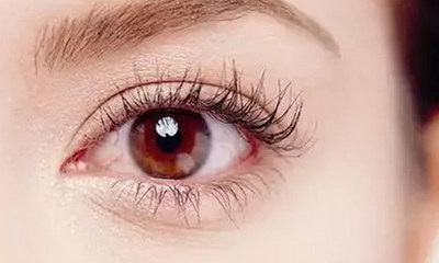 怎么可以去眼睛上的血丝_割眼线能让眼睛变大吗