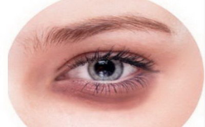 双眼皮瘢痕怎么修复