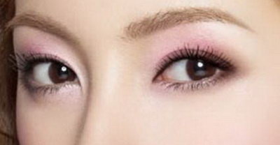韩式双眼皮的优点是什么呢