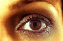 双眼皮修复手术常见问题