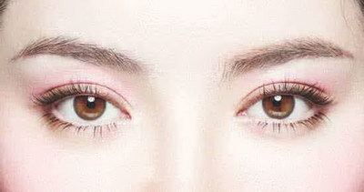 双眼皮手术多久戴美瞳_双眼皮手术和埋线区别