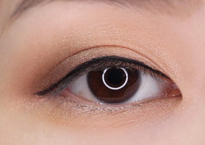近视眼手术做完眼睛会变大吗「近视眼手术之后眼睛会变大吗」