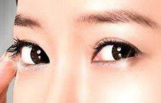做完韩式双眼皮手术多长时间能恢复你知道吗?