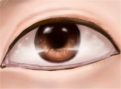 激光近视眼治疗方法(激光近视眼治疗中心)