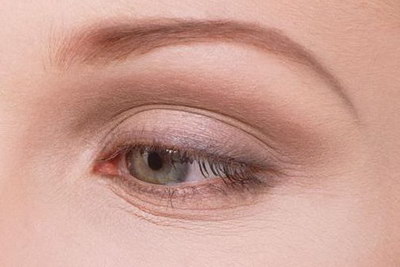 埋线双眼皮修复要多久呢？