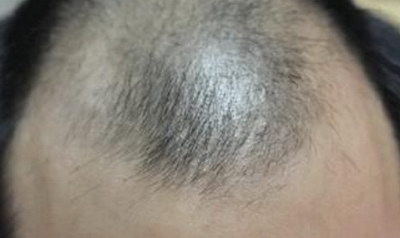 男头发多长可以烫(6个月头发可以长多长婴儿)