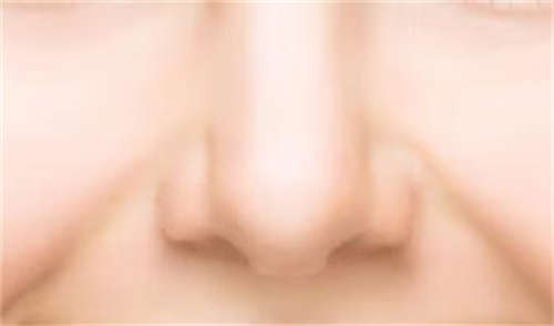 2023年都江堰市韩式3D复合隆鼻权威的整形医生是哪家
